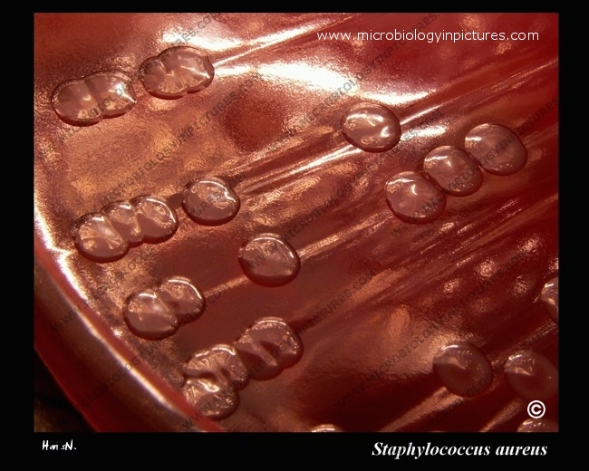 s.aureus detail of colonies on blood agar